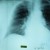 Современные методы обследования в дифференциальной диагностике туберкулеза