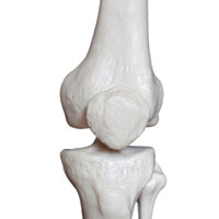 Эффективен ли хондроитин при остеоартрите?