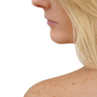 Генетические маркеры развития меланомы: от чего зависит прогноз заболевания?