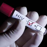 Новый подход в лечении ВИЧ-инфекции продемонстрировал обнадеживающие результаты