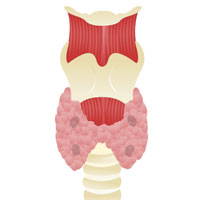 Лазерная абляция — эффективный и малоинвазивный метод удаления новообразований