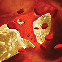 Какие дополнительные риски содержат заболевания периферических артерий?