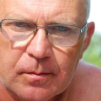 Неагрессивные формы рака предстательной железы: какую стратегию лечения выбрать?