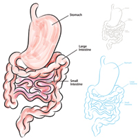 Пищевая аллергия может определять риск развития синдрома раздраженного кишечника