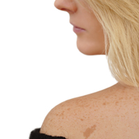 FDA предлагает запретить использование соляриев лицами моложе 18 лет