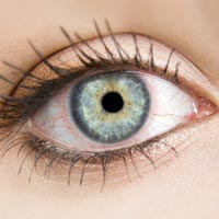 Синдром сухого глаза ассоциирован с хроническим болевым синдромом