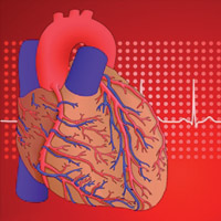 Какое заболевание сердечно-сосудистой системы является предиктором рака?