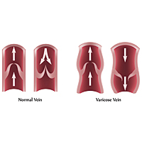 Конференція «Актуальні питання флебології» відбулася в місті Яремче