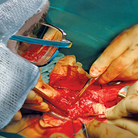 Конференція «Актуальні питання торакальної хірургії»