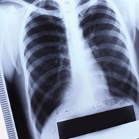 Науково-практична конференція «X Національний астма-конгрес»