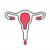 Затверджено Стандарти медичної допомоги «Лейоміома матки»